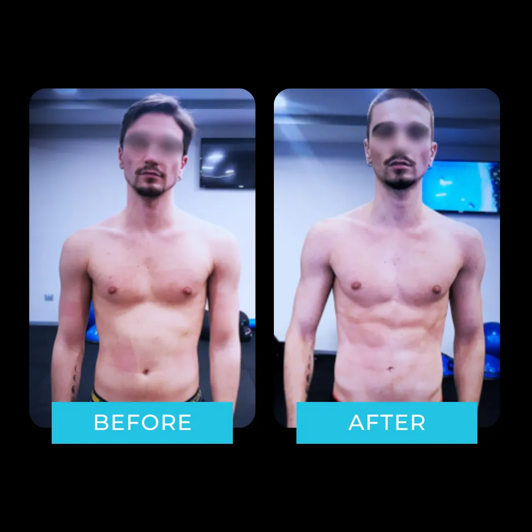 Antes y después i-Motion Sport