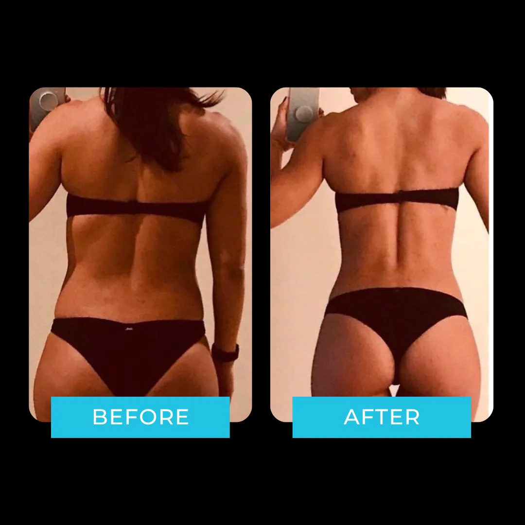 Antes y después i-Motion Sport